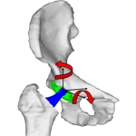 3D hip joint