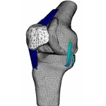 3D knee model
