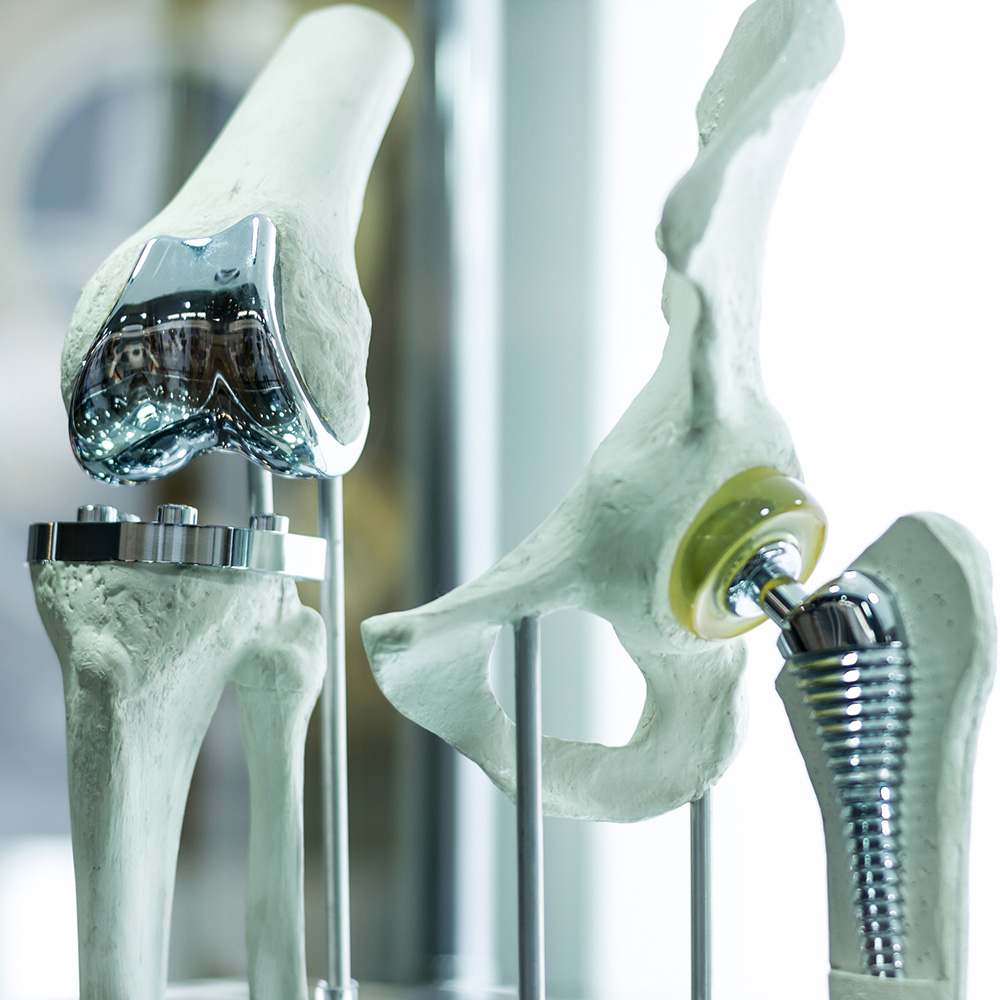 Modern knee and hip prosthesis made by cad engineer and manufactured by 3d printing